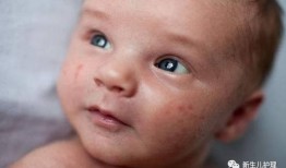 吃瓜嘴巴肿了,嘴巴肿成“香瓜”的尴尬经历