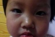 吃瓜嘴巴肿了,嘴巴肿成“香瓜”的尴尬经历